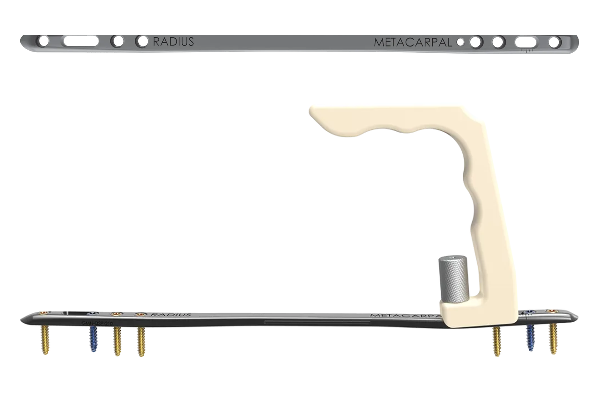 Dorsal Spanning Plate