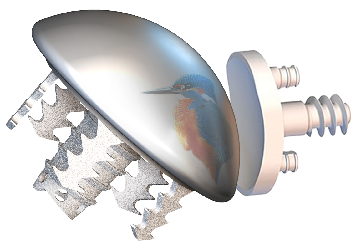 Easytech Anatomical stemless shoulder — FX Shoulder Solutions