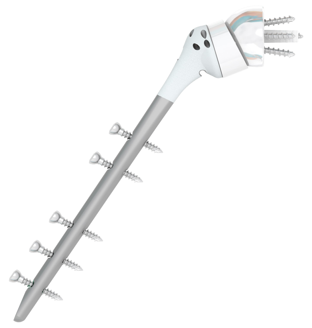 FX Shoulder V135 interlocking long stem