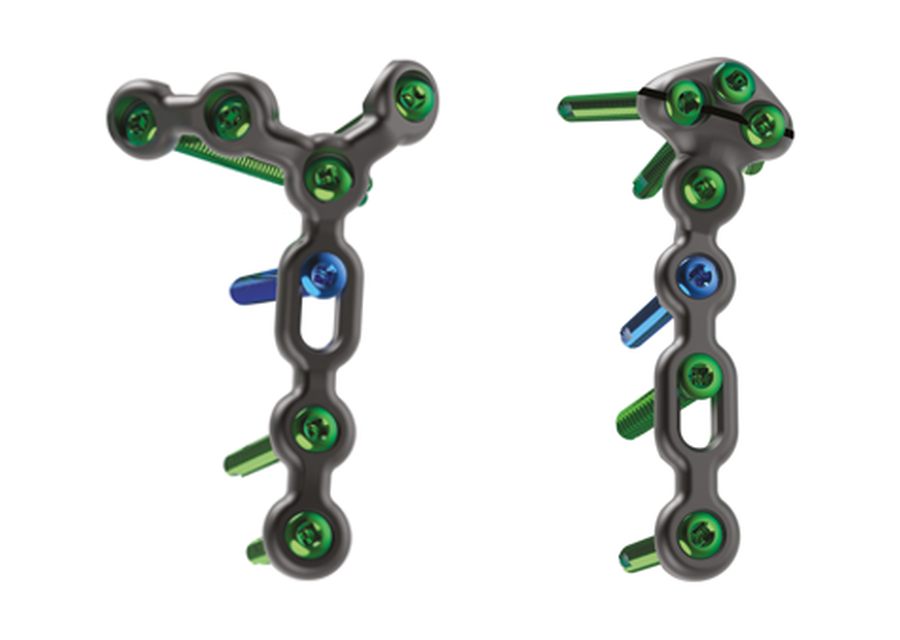PROTEAN fragment plates — Skeletal Dynamics